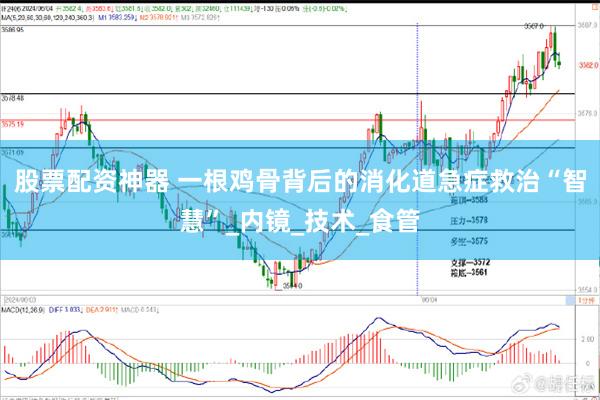 股票配资神器 一根鸡骨背后的消化道急症救治“智慧”_内镜_技术_食管